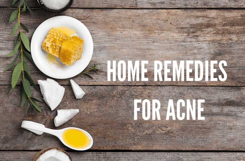  Best Acne Remedies That Will Give You A Clear Skin