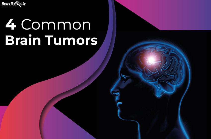  4 Most Common Brain Tumors You Should Know About