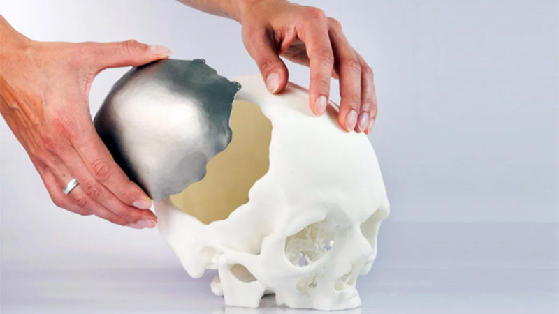 3d-printed-bones