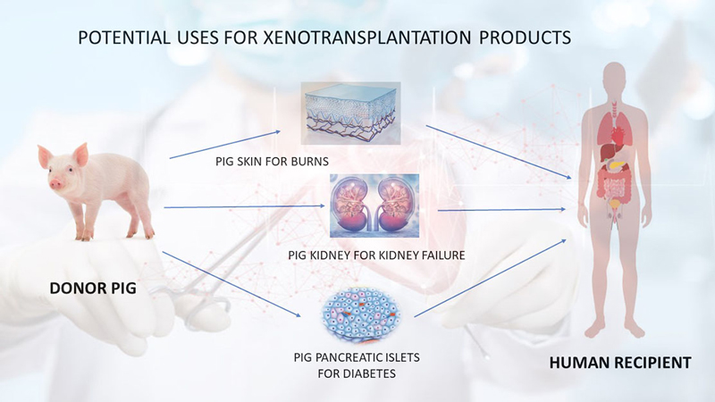 xenotransplantation